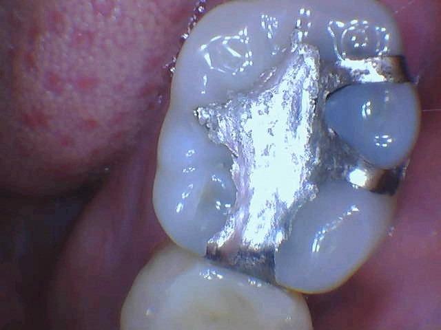 DY-50 Intraoral Camera Dental Camera Super Clear Button Driver Included Work W/Eaglesoft Dexis More customer photo 1