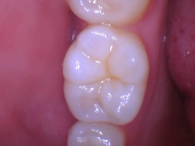 DY-50 Intraoral Camera Dental Camera Super Clear Button Driver Included Work W/Eaglesoft Dexis More customer photo 2