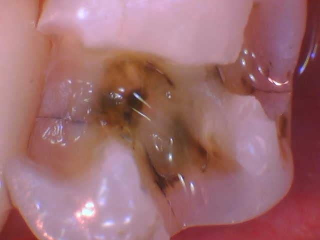 ProDENT Intraoral Camera PD740, Capture Button Driver to Work with Eaglesoft, Dexis, Apeteryx, Carestream, Tigerview customer photo 2