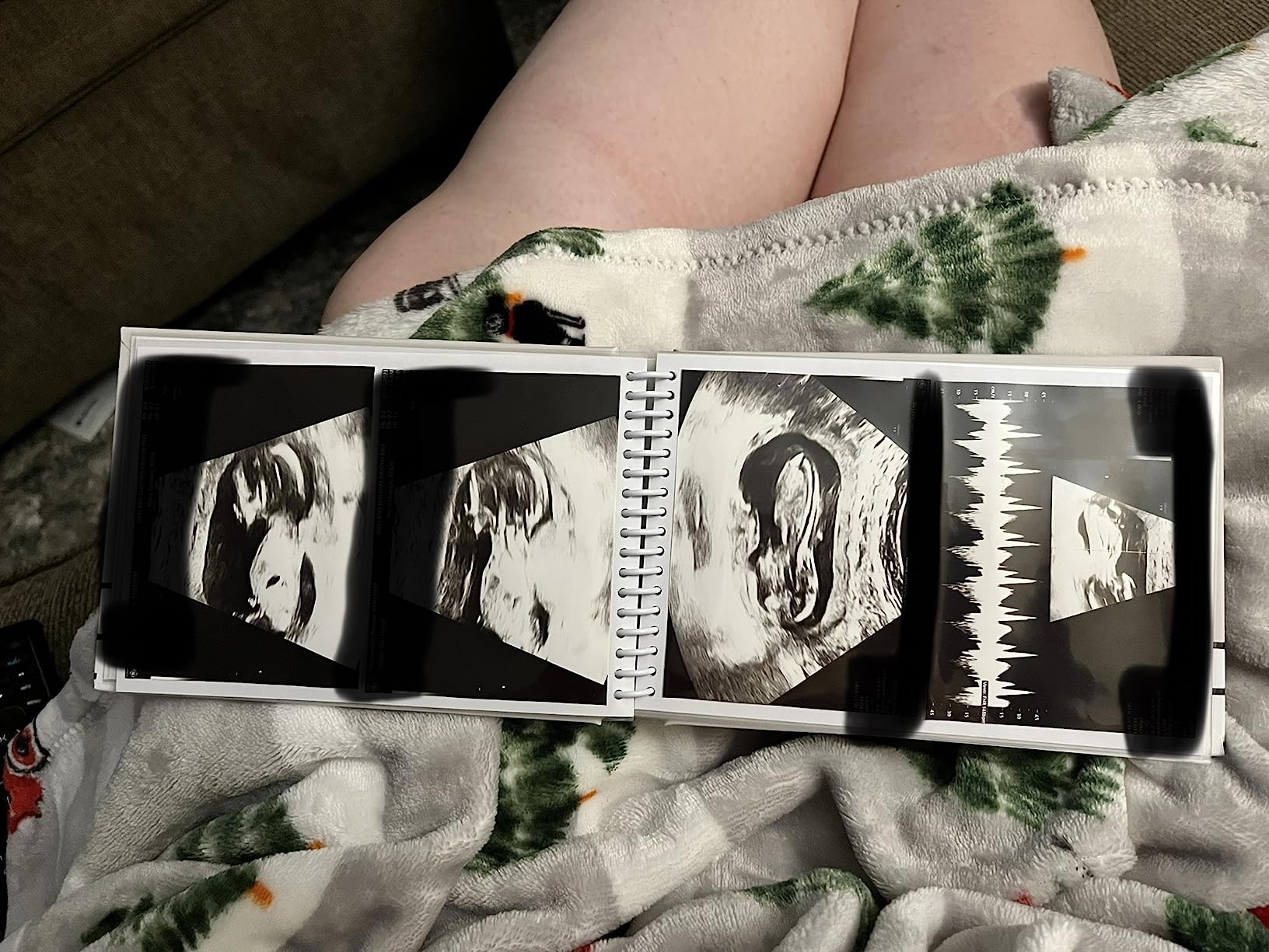 Pearhead Baby Photo Album, Keepsake Baby Memory Book with Photo Pockets, Gray and White Polka Dot Cover customer photo 1