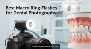 Best Macro Ring Flashes for Dental Photography
