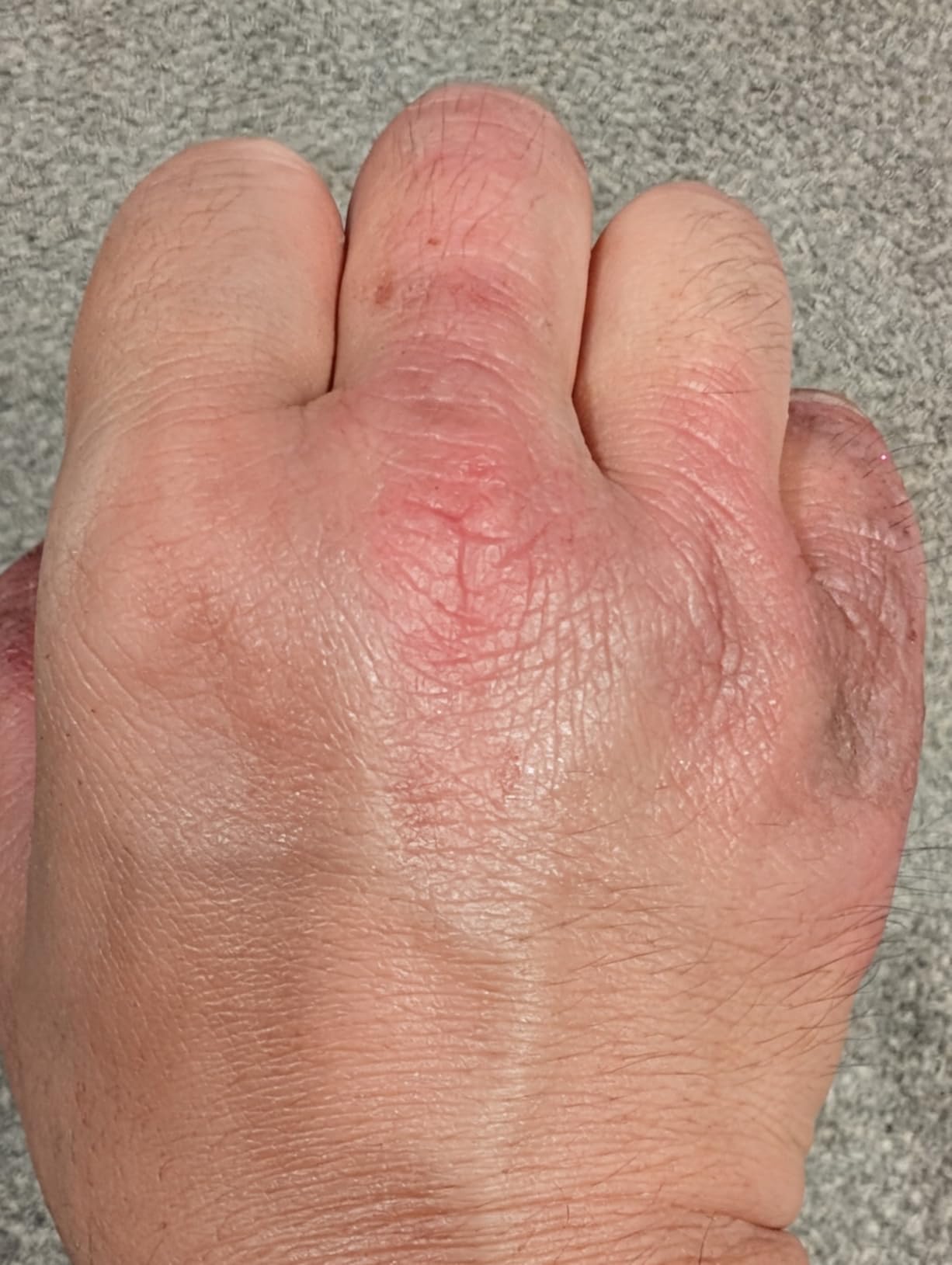 La Roche-Posay Lipikar AP+MAX Triple Repair Moisturizing Body Cream | Face & Body Lotion for Dry Skin with Shea Butter & Niacinamide customer photo 2