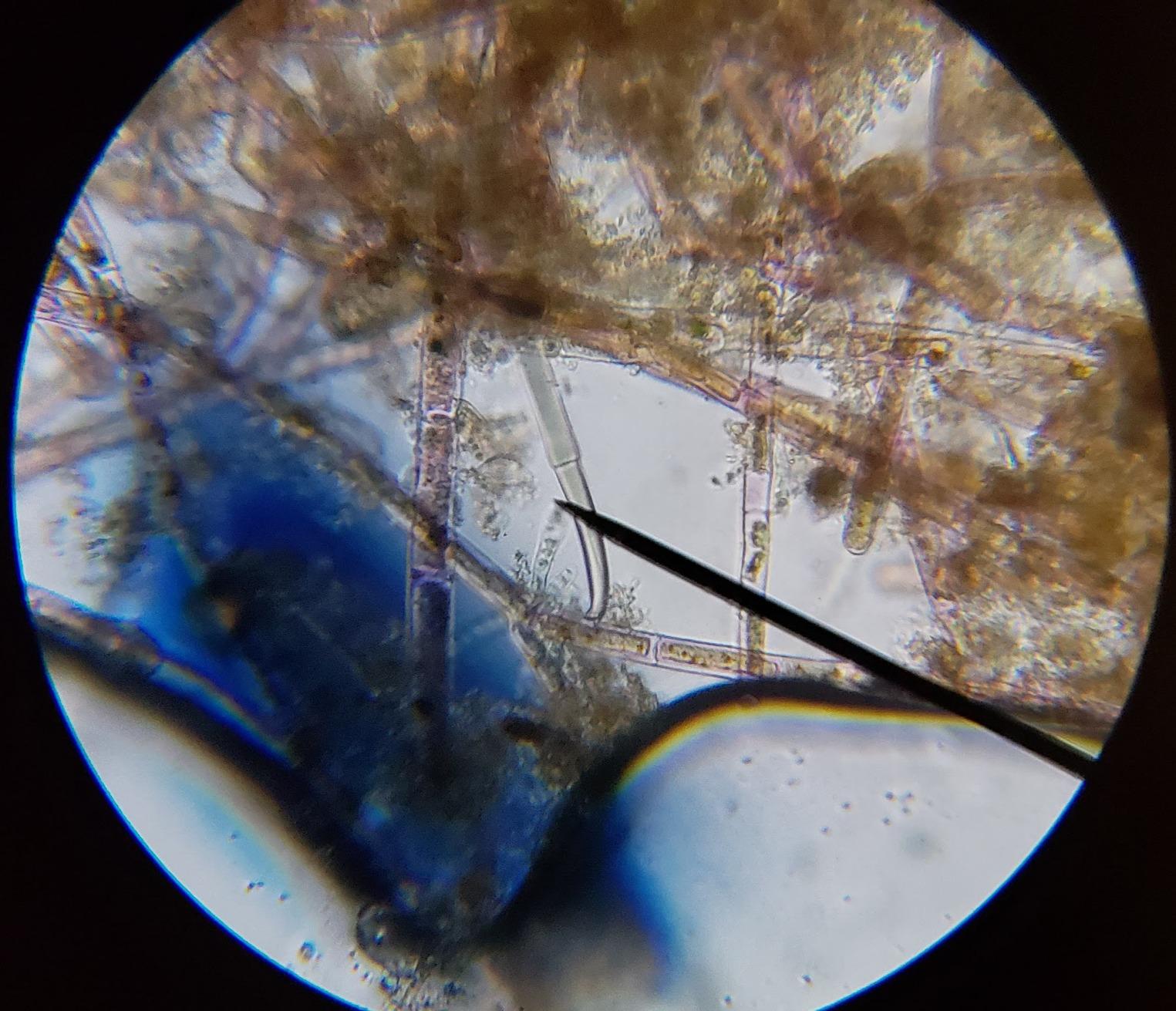 AmScope M150C / M150C-I 40X-1000X All-Metal Optical Glass Lenses Cordless LED Student Biological Compound Microscope customer photo 2
