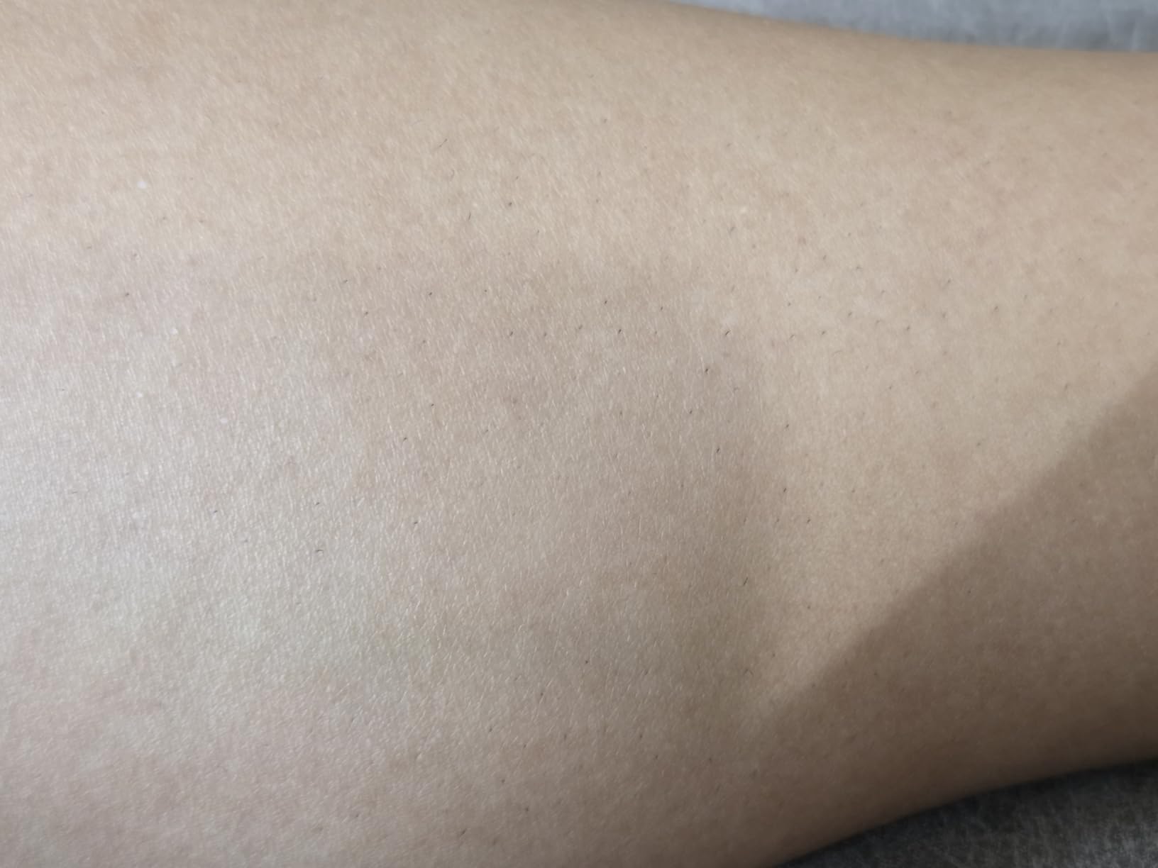 Braun IPL, Silk·Expert Pro 5, IPL Hair Removal for Women and Men, Permanent Laser Hair Reduction At-Home, 2 Heads, Pouch, IPL5137 customer photo 2