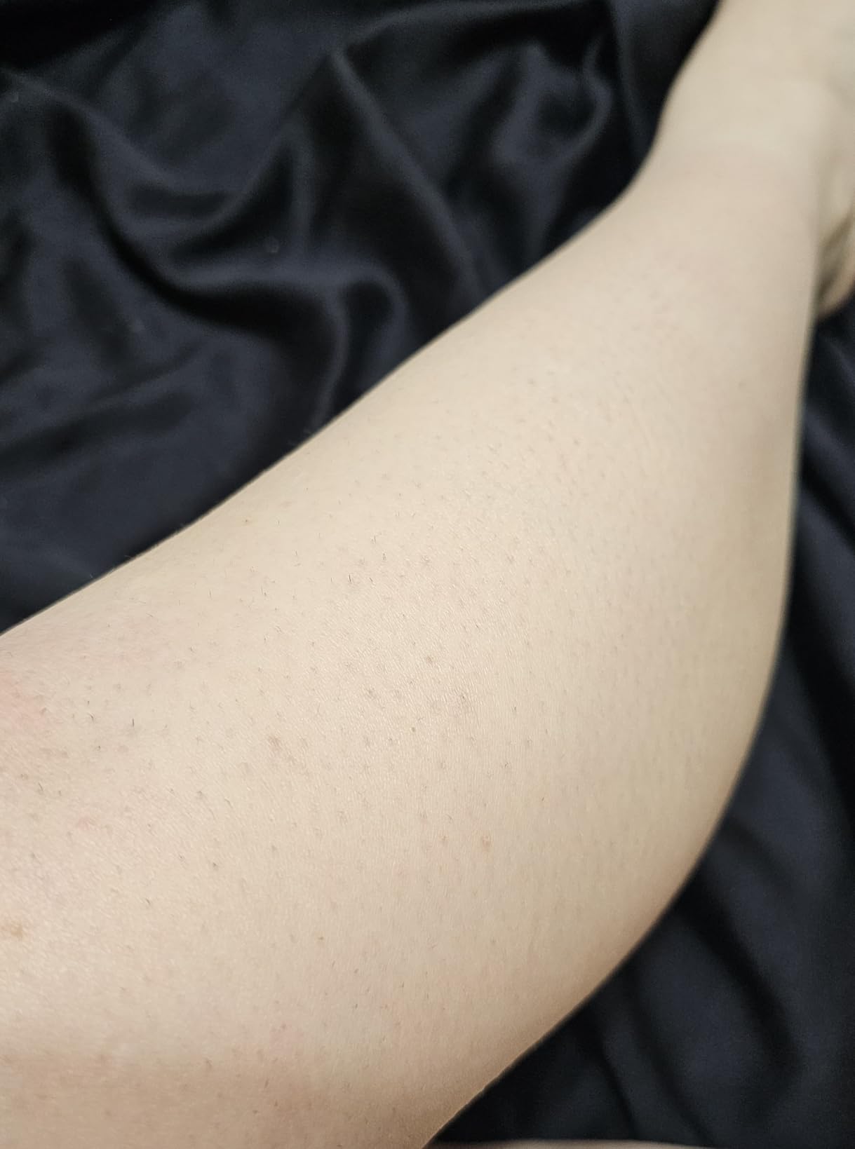 Philips Lumea 9000 Series IPL Hair Removal Device Permanent Laser Hair Reduction for Women & Men, Easy and Comfortable Use at Home, SenseIQ, 4 Attachments for Body, Face, Bikini & Underarms, BRI984/03 customer photo 2