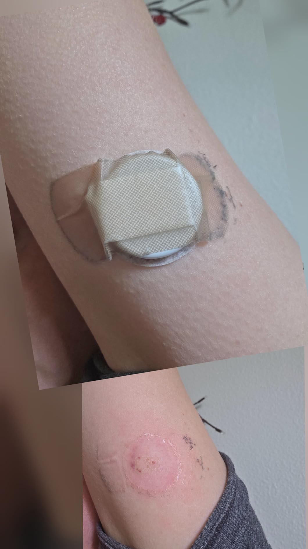Lingo Continuous Glucose Monitor (CGM) & App (Pack of 2). Made by Abbott. Optimize Your Nutrition with Real-time Glucose Data & Insights. 1 Lingo biosensor lasts up to 14 Days*. Works with iOS and Android. US Only. customer photo 2