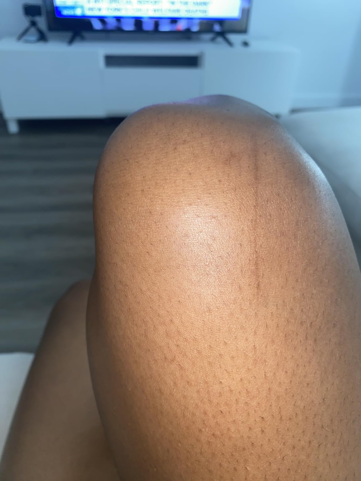 Dr Pen Microneedling Pen M8S for Home Use customer photo 1
