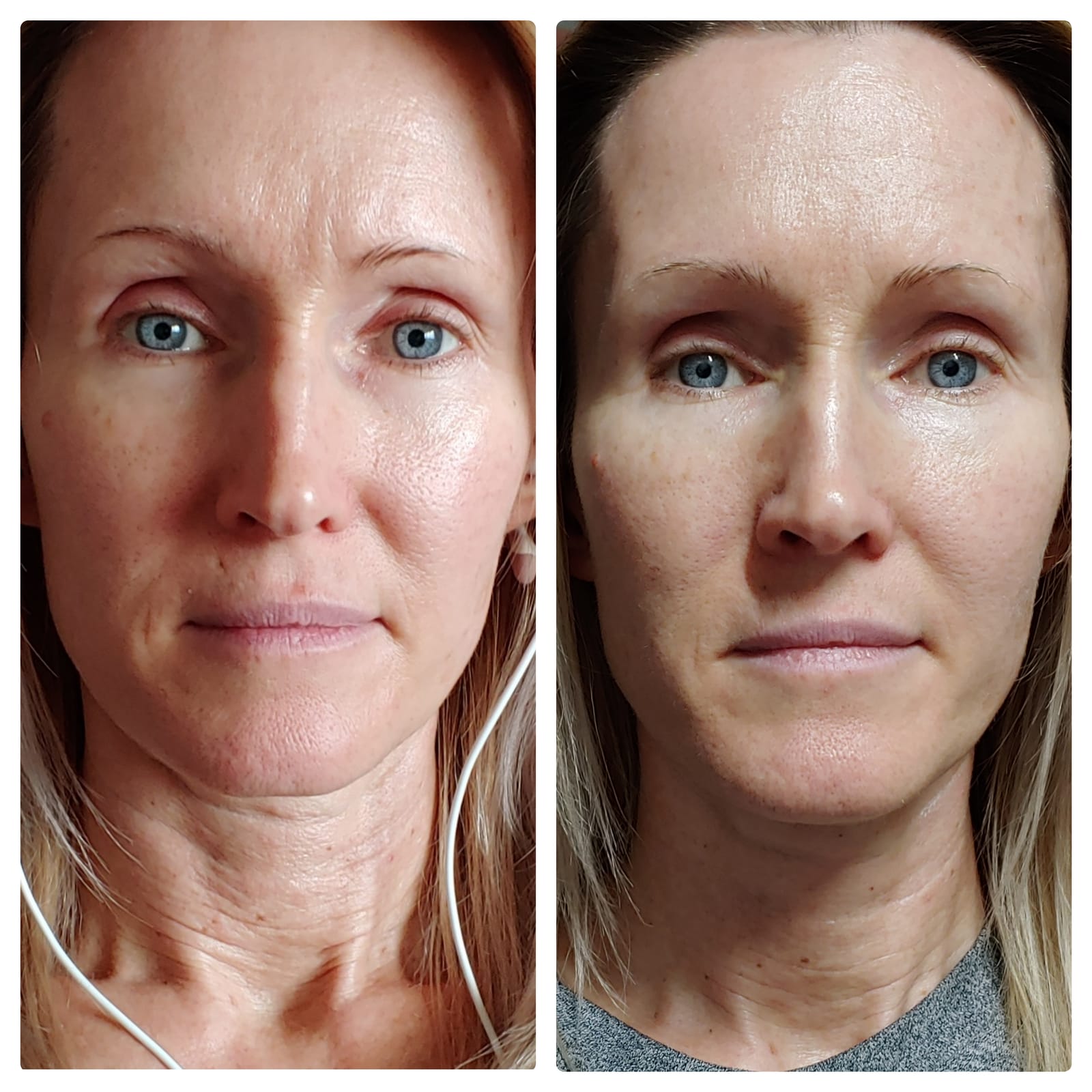 Project E Beauty Portable Rechargeable Galvanic Device | Skin Care Reduce Wrinkles Skin Tightening Firming Fine Lines Desincrustation Deep Pore Cleansing Rejuvenation Device customer photo 1