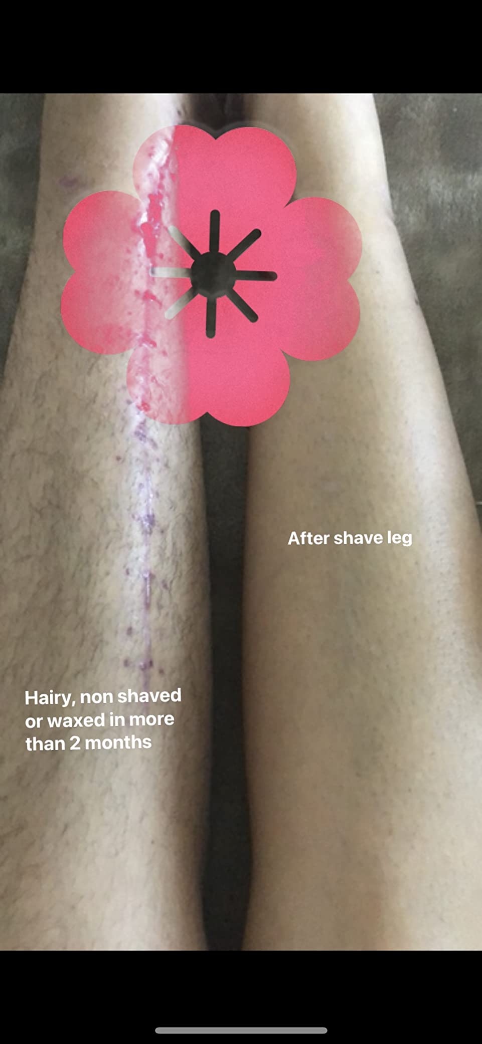 Braun IPL, Silk·Expert Pro 5, IPL Hair Removal for Women and Men, Permanent Laser Hair Reduction At-Home, 2 Heads, Pouch, Venus Razor, IPL5157 customer photo 2