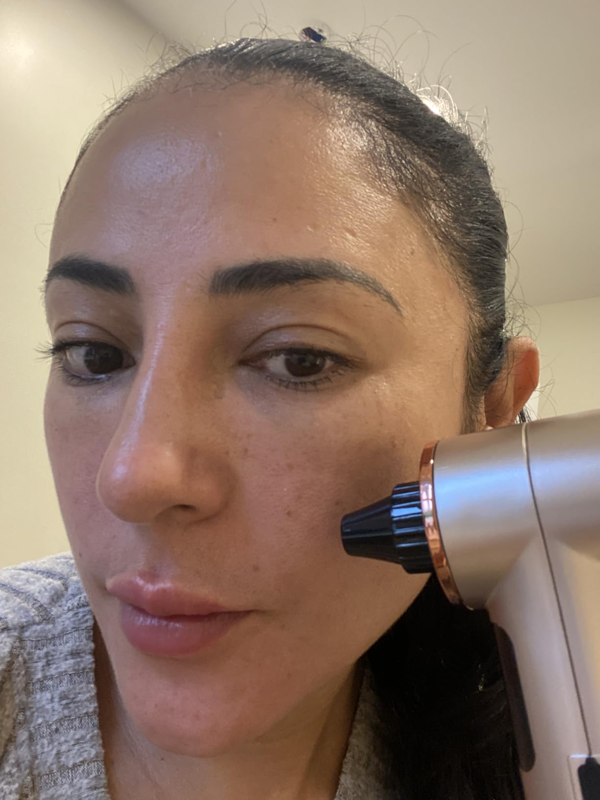 Heated Blackhead Remover Vacuum, Warm Compress Pore Vacuum Cleaner with 3 Suction Levels, LED Display, USB Rechargeable Facial Pore Cleaner Kit, 5 Heads and 4 Stainless Steel Tools (Purple) customer photo 1