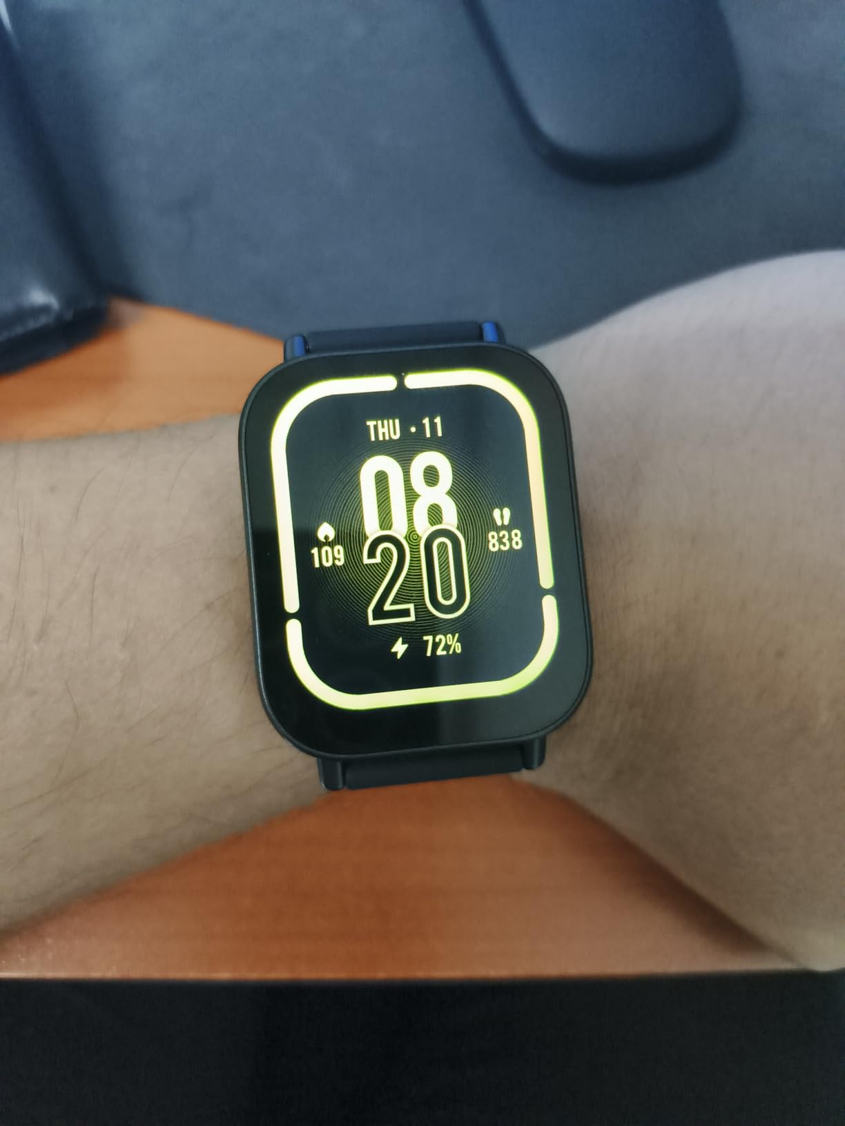 Xiaomi Redmi Watch 5 customer photo 2